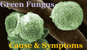 Green Fungus Symptoms, Green Fungal Cause, Treatment Precautions